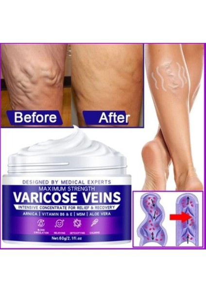 Strength Varicose Vein Tedavi Kremi 100 ml x 2 Adet fiyatları