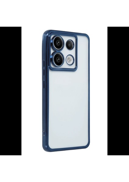 Xiaomi Redmi Note 13 Pro 4g Kılıf Razer Lensli Silikon fiyatları