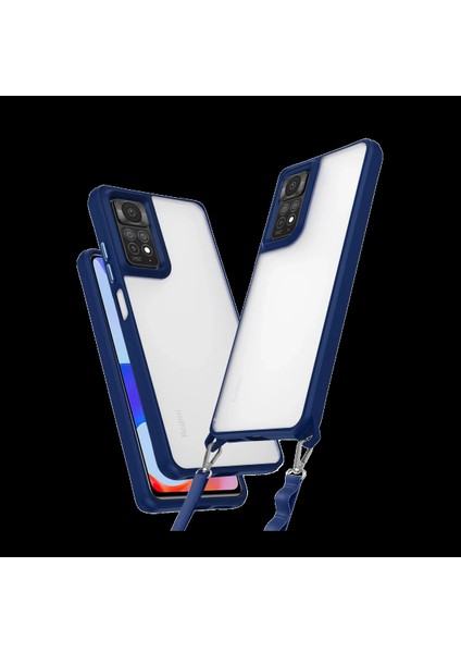 Xiaomi Redmi Note 11 Pro Kılıf Penta Silikon Kılıf