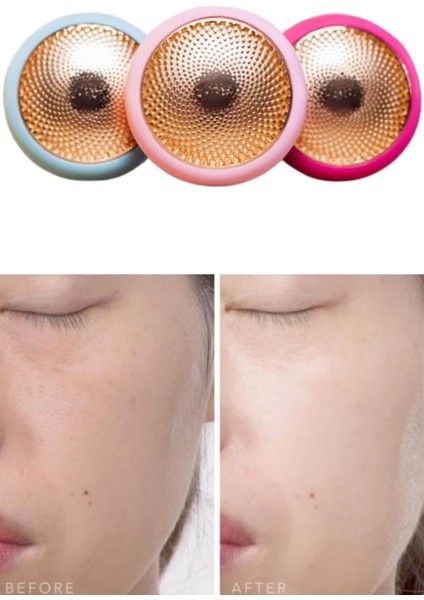 Depomix Mini Saç Derisi Masaj Aleti LED Işık Terapisi Cildi Yatıştırır ve Dengeler indirimleri