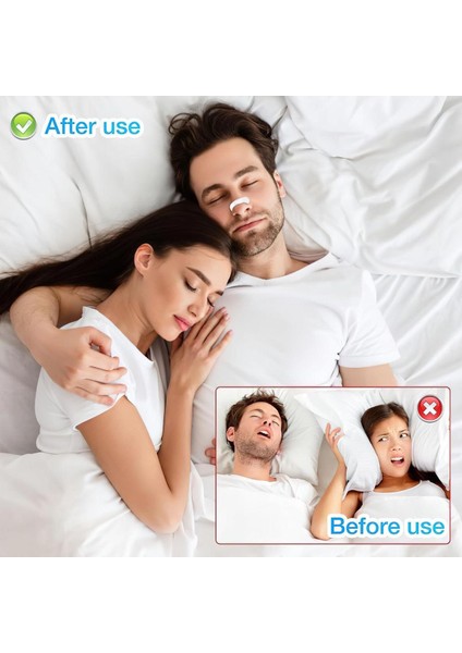 Orijinal Manyetik Burun Bandı – 60 Adet | Nefes Açıcı & Horlamayı Azaltıcı | Siyah (Orijinal) modelleri