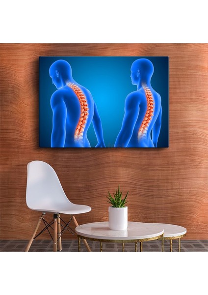Fizyoterapist - Omurga Sağlığı Kanvas Tablo