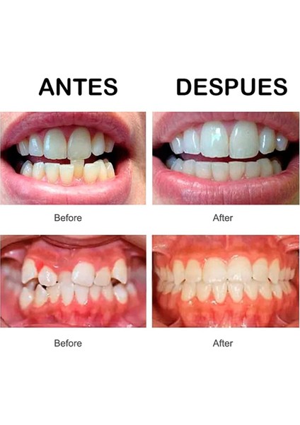 Diş Retainerları Gece Diş Gıcırdatma Için Retainer Ağız Koruyucusu Gece Diş Gıcırdatma Için Retainer Ağız Koruyucusu (Yurt Dışından) fırsatları