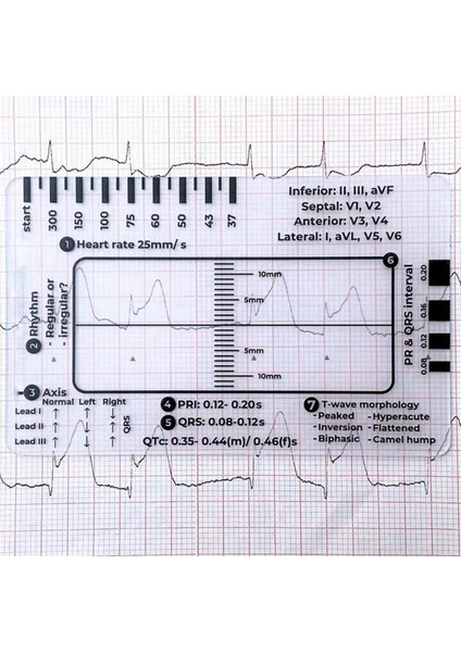 Ekg 7 Adımlı Cetvel, Ekg/ekg Yorumlama Için Ekg 7 Adımlı Cetvel, Ekg Referans Kılavuzu Cetveli, Ekg Kaliper Ölçüm Aracı (Yurt Dışından) modelleri