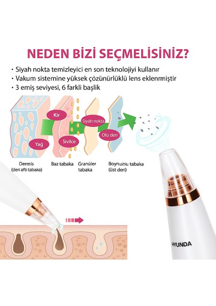Hyundai Vakumlu Siyah Nokta Temizleyici – 6 Başlık, Güçlü Vakum, Şarjlı fırsatları