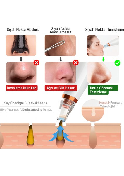 FC-038 Vakumlu Siyah Nokta Temizleyici 3 Modlu Emiş Gücü Cilt Gözenek Temizleyici indirimleri