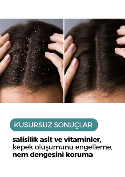 Kepek Karşıtı Saç Bakım Toniği 150 ml modelleri