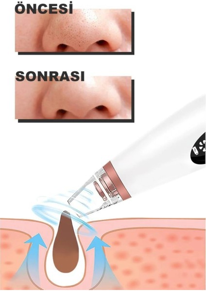 Hyundaı Dijital Göstergeli 6 Başlıklı Cilt Temizleme Vakum Aleti Turuncu Beyaz Detaylı indirimleri