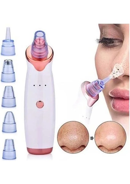 Şarjlı Siyah Nokta Temizleme Cihazı 5 Başlıklı (5224) indirimleri