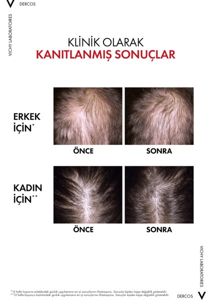 Vichy Dercos Aminexil Clinical R.e.g.e.n. Booster 90 ml modelleri