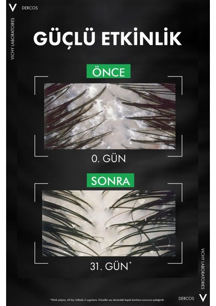 Asfstore Vichy Dercos Anti Dandruff Kuru Saçlar Için Kepek Karşıtı Şampuan Refill 390 ml fırsatları