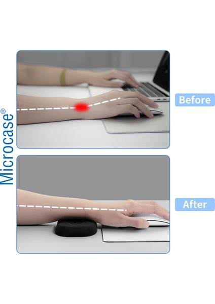 Ergonomik Klavye Bilek Destek + Mouse Bilek Destek 2in1 Set - AL5378 fiyatları