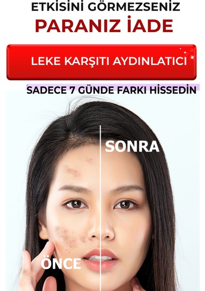 Leke Giderici Sérum BrightFix Series A200