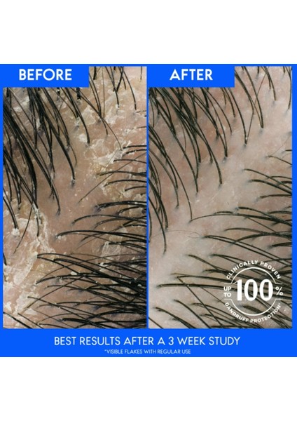 & Shoulders Tea Tree Oıl 2 In 1 Hydrates Refreshes Relives Itch Kremli Şampuan 835 ml modelleri