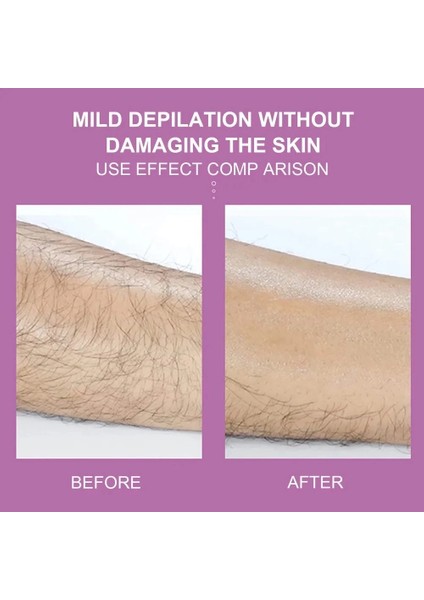 Epilatör Kristal Epilasyon Aleti ( Lisinya ) fiyatları