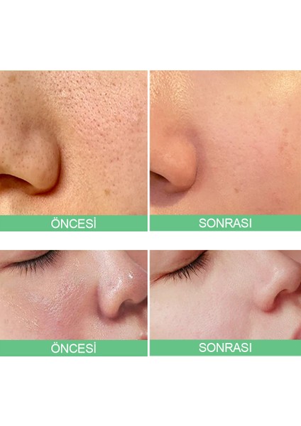 Sungboon Green Tomato Pore Lifting Ampoule / Gözenek Sıkılaştırıcı ve Cilt Toparlayıcı Serum 30ML modelleri