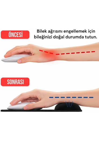 Bilek Destekli Mousepad - Kaymaz Mouse Ped - Fare Pedi - Oval Mouse Altlığı - Oval Mousepad - Mouseped