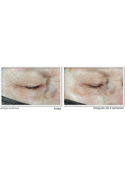 Multi Correxion Hydrate Plump Göz Çevresi Kremi 15ML