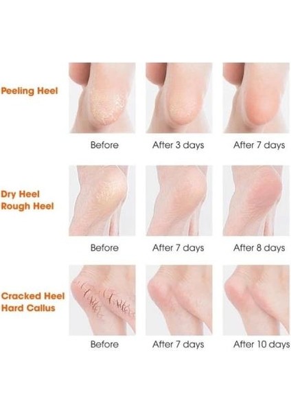 Silikon Topuk Nemlendirici Çorap