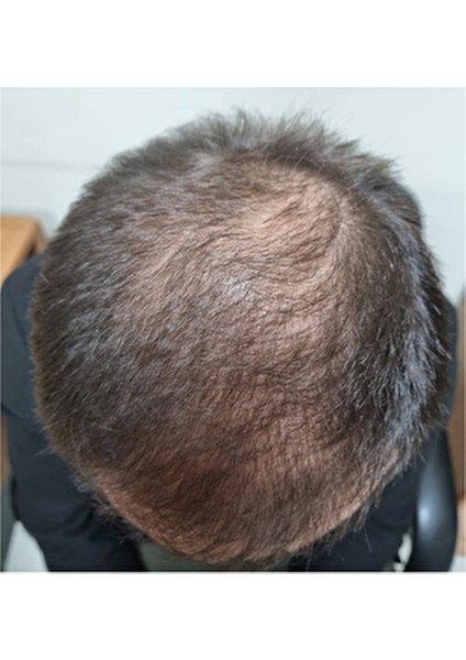 Takviye Edici Gıda Dökülme Karşıtı Vegan Formül 60 Kapsül Zayıf Saçlar İçin