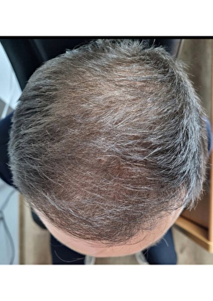 Takviye Edici Gıda Dökülme Karşıtı Vegan Formül 60 Kapsül Zayıf Saçlar İçin