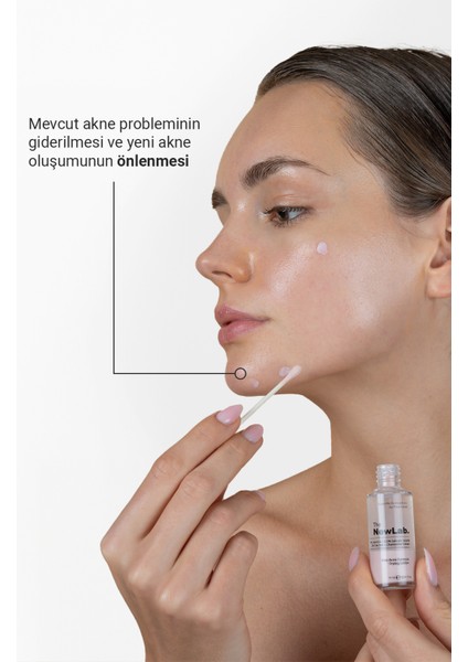 Anti-Acne Formula Drying Lotion