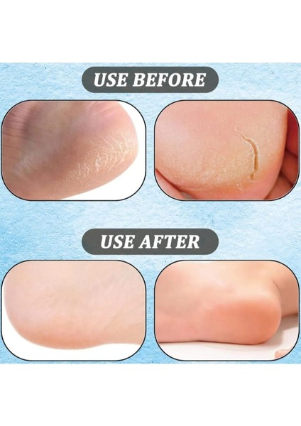 Topuk Çatlağı Giderici Onarıcı Ayak Bakım Çorabı Kuruluk ve Sertlik Önleyici Krem Çorabı