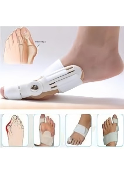 Ayak Baş Parmak Düzeltici Kemik Koruyucu Gece Ateli Bunyon modelleri