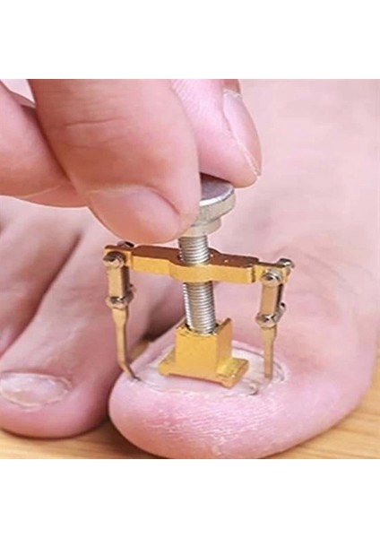 Batan Tırnak Düzeltme Aleti Batık Tırnak Çıkarıcı Aparat ( Lisinya ) fiyatları