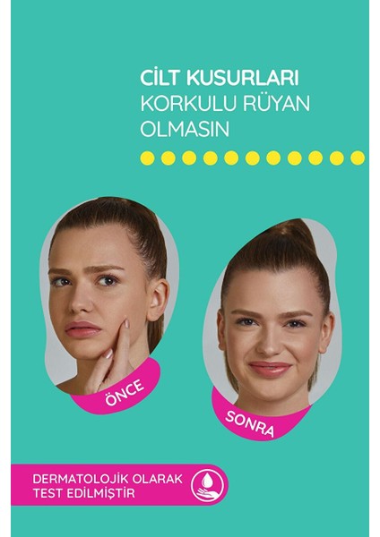 Sos Band - 15 Adet Sivilce/akne Patch fırsatları