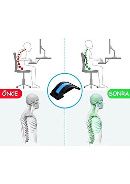 Vücut Dik Duruş Aleti Omuz Sırt Bel Omurga Düzleştirici 3 Kademeli Spor Aleti Sırt Rahatlatıcı indirimleri