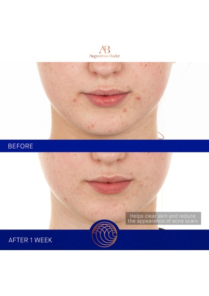 The Retinol Serum 15ML