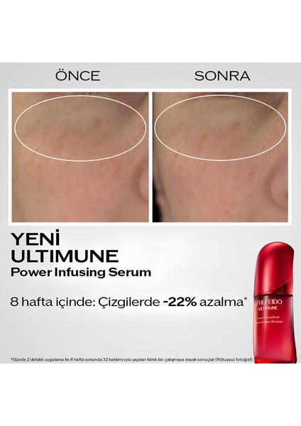 Ultimune Power Infusing Concentrate Serum 30 ml indirimleri