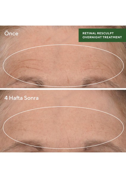 Retinal Resculpt Overnight Treatment - Retinal Içeren Yenileyici Mucize Gece Serumu indirimleri