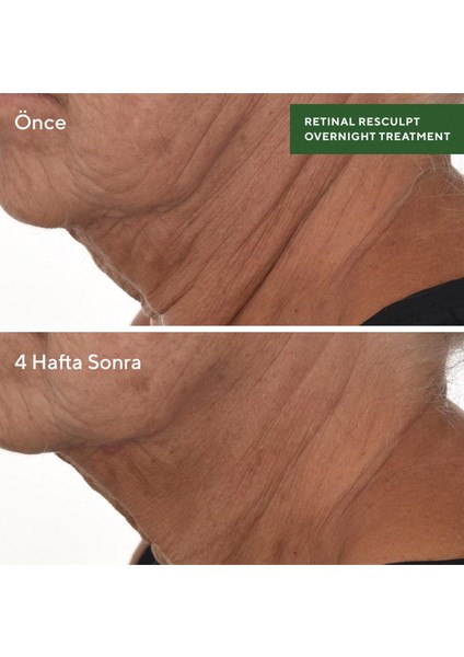 Retinal Resculpt Overnight Treatment - Retinal Içeren Yenileyici Mucize Gece Serumu
