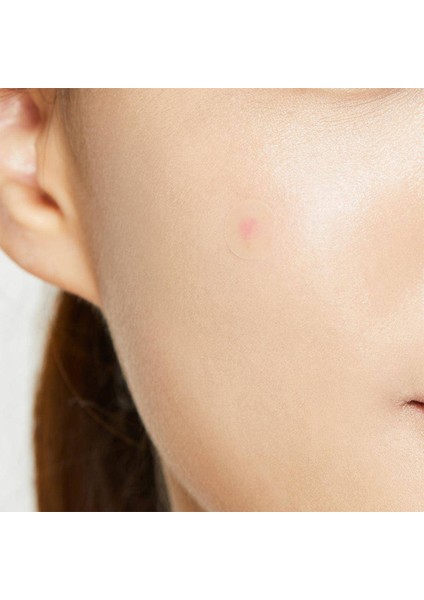 Acne Pimple Master Patch 24'lü Akne Söndürücü Şeffaf Sivilce Bandı modelleri