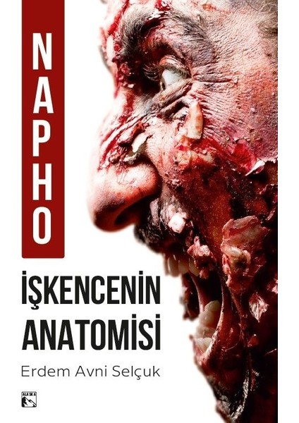 Napho Işkencenin Anatomisi