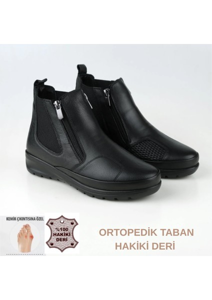 Tam Ortopedik Taban Hakiki Deri Kemik Çıkıntısı Anne Botu