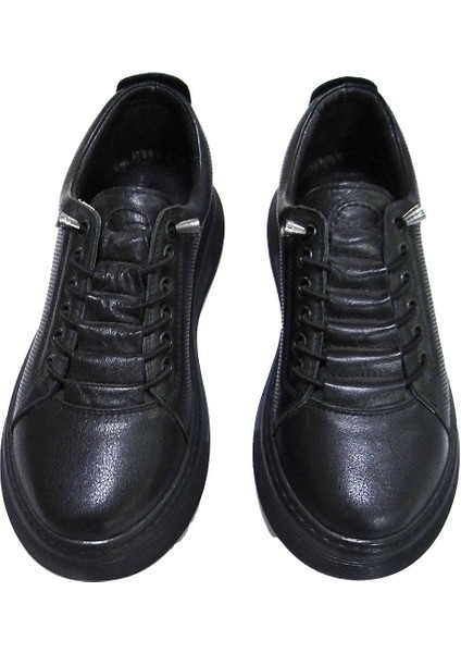 Hamile Ayakkabıları Model5 40