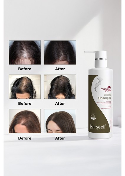 Anti Hair Loss Dökülme Önleyici Şampuan 500 ml fırsatları