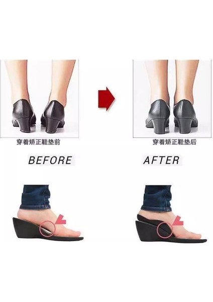 Düz Tabanı Yükseltmek Için Esnek Topuk Yastığı modelleri