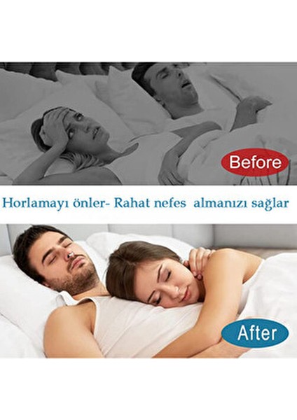 Burun Klipsi Manyetik Şeffaf Hafif ve Dayanıklı Kullanım Kolaylığı 1 Adet