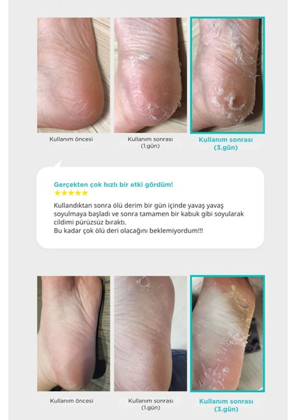 Smooth & Pure Foot Peeling Mask Nourishing - Çorap Tipi Yoğun Besleyici Ayak Peeling Maskesi
