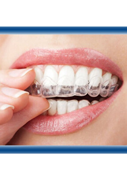 Diş Gıcırdatma Diş Sıkma Önleyici Gece Plağı - Bruksizm Aparatı