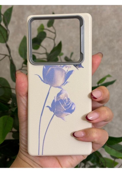 Infinix Note 40 Pro Kılıf Desenli Kamera Koruma Çıkıntılı Soft Tasarım Elde Kaymayan Kapak