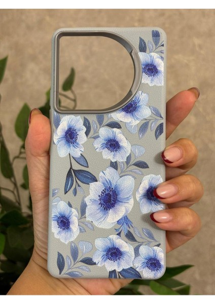 Tecno Camon 30 Kılıf Desenli Kamera Koruma Çıkıntılı Soft Tasarım Elde Kaymayan Kapak