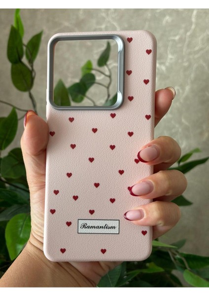 Xiaomi Redmi Note 14 4g Kılıf Desenli Kamera Koruma Çıkıntılı Soft Tasarım Elde Kaymayan Kapak