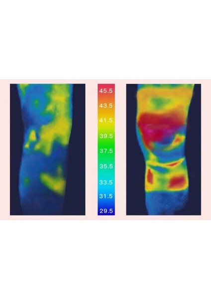Polyester Kadife Cepli Diz Koruyucusu (Yurt Dışından) fiyatları