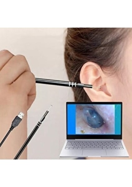Kulak Muayene Endeskop Kamera 720P USB Görsel Temizlik Aracı Siyah Renkli 3-In-1