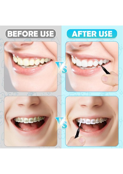 120 Adet Diş Arası Fırçası, Diş Teli Fırçası Temizleyici, Diş Temizleme Aletleri, Etkili Ağız Bakımı Için Spiral Diş Fırçası (Yurt Dışından) modelleri